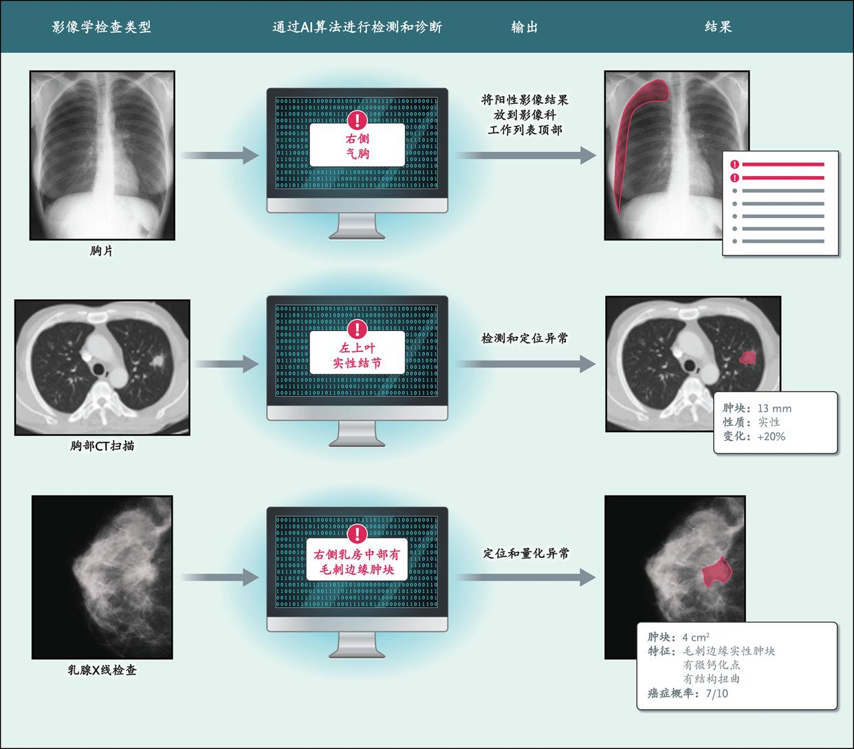 AI助力传统医疗影像诊断困局